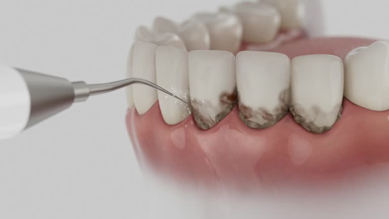 Reliable Tooth Extraction contractor in Botetourt County County, VA by Dentist Open Now